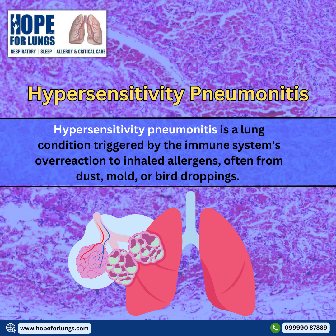 Hypersensitivity Pneumonitis